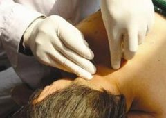 中医治疗颈椎病