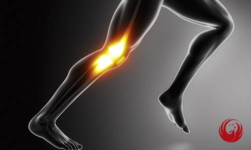 ·关节预防措施之膝关节伤病预防